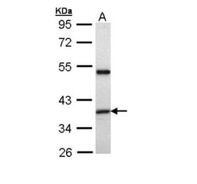 XAP2 antibody from Signalway Antibody (22949) - Antibodies.com