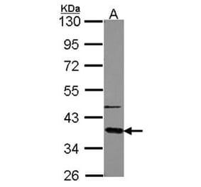 GNAT2 antibody from Signalway Antibody (23007) - Antibodies.com