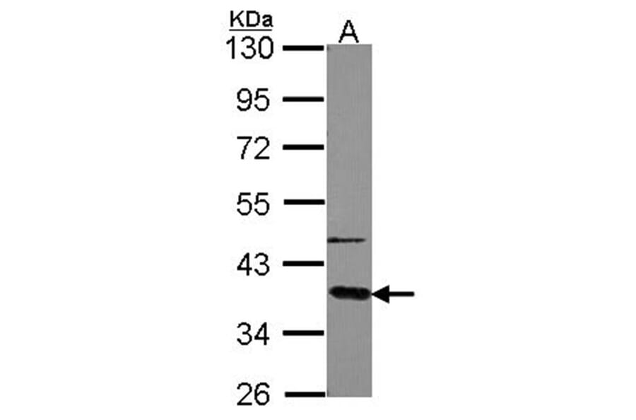 GNAT2 antibody from Signalway Antibody (23007) - Antibodies.com