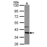 GNAT2 antibody from Signalway Antibody (23007) - Antibodies.com