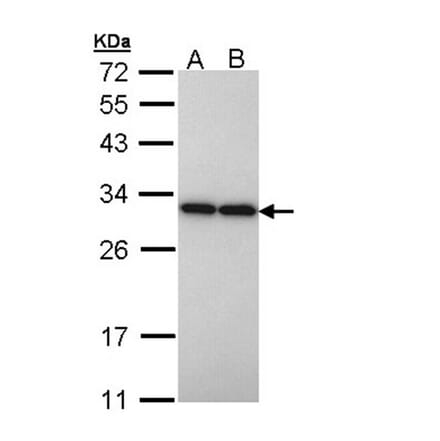 PGAM2 antibody from Signalway Antibody (23052) - Antibodies.com