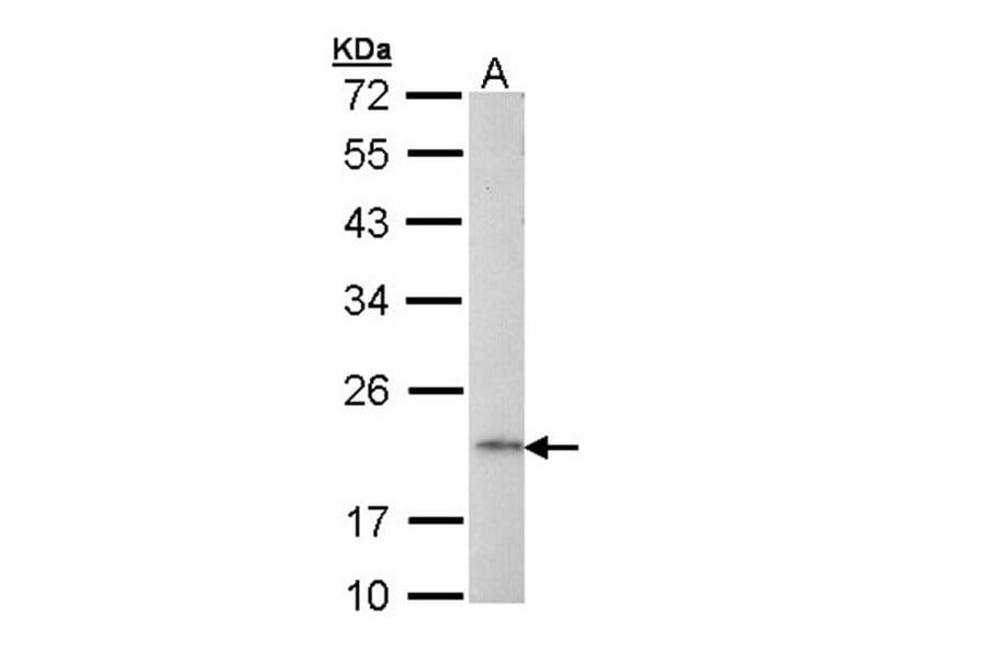 AP1S2 antibody from Signalway Antibody (23094) - Antibodies.com