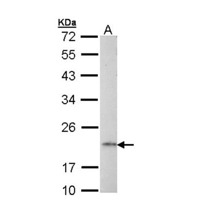 AP1S2 antibody from Signalway Antibody (23094) - Antibodies.com