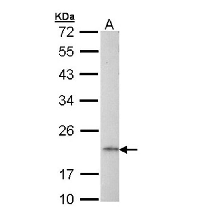 AP1S2 antibody from Signalway Antibody (23094) - Antibodies.com
