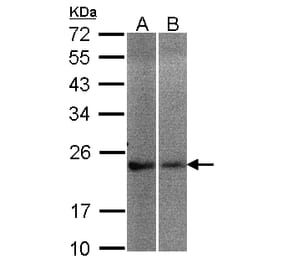 NCS-1 antibody from Signalway Antibody (23119) - Antibodies.com