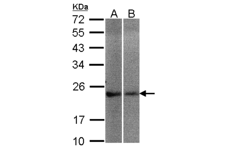 NCS-1 antibody from Signalway Antibody (23119) - Antibodies.com