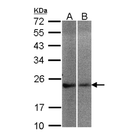 NCS-1 antibody from Signalway Antibody (23119) - Antibodies.com