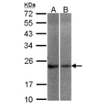 NCS-1 antibody from Signalway Antibody (23119) - Antibodies.com