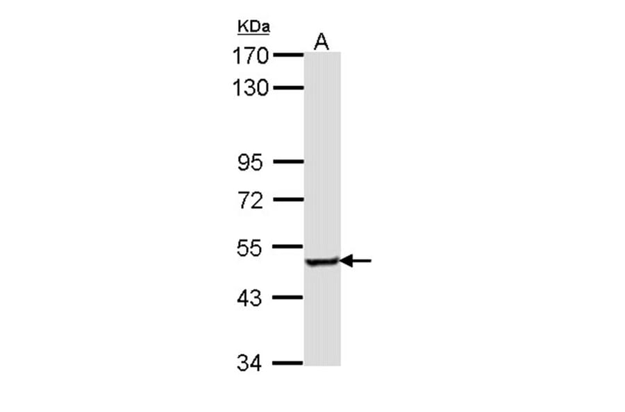 SESN3 antibody from Signalway Antibody (23170) - Antibodies.com