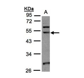 NSUN6 antibody from Signalway Antibody (23177) - Antibodies.com