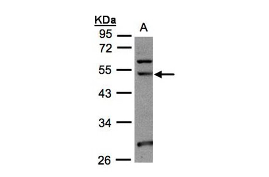 NSUN6 antibody from Signalway Antibody (23177) - Antibodies.com