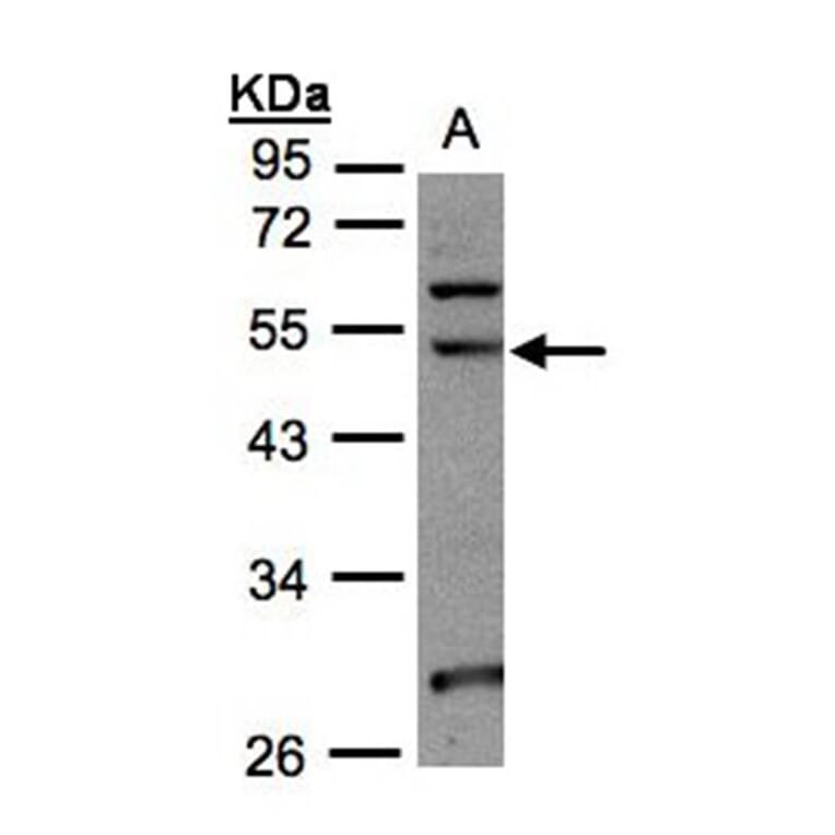NSUN6 antibody from Signalway Antibody (23177) - Antibodies.com