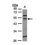 NSUN6 antibody from Signalway Antibody (23177) - Antibodies.com
