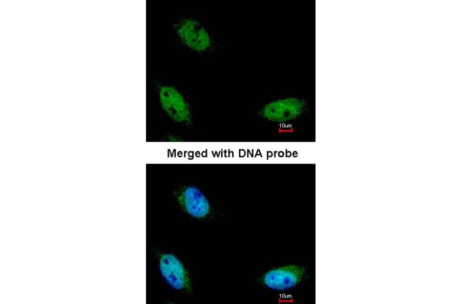 Immunofluorescence - NSUN6 antibody from Signalway Antibody (23177) - Antibodies.com