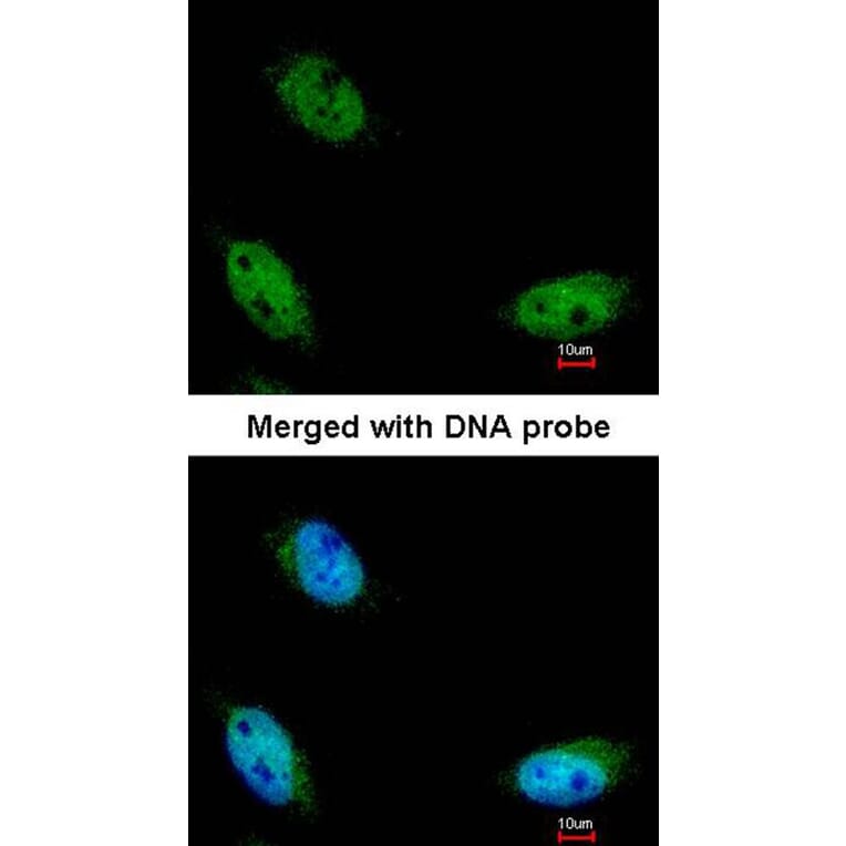 Immunofluorescence - NSUN6 antibody from Signalway Antibody (23177) - Antibodies.com