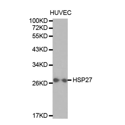 Western blot - HSPB1 Antibody from Signalway Antibody (32036) - Antibodies.com
