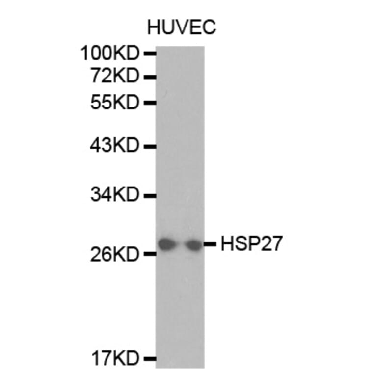 Western blot - HSPB1 Antibody from Signalway Antibody (32036) - Antibodies.com