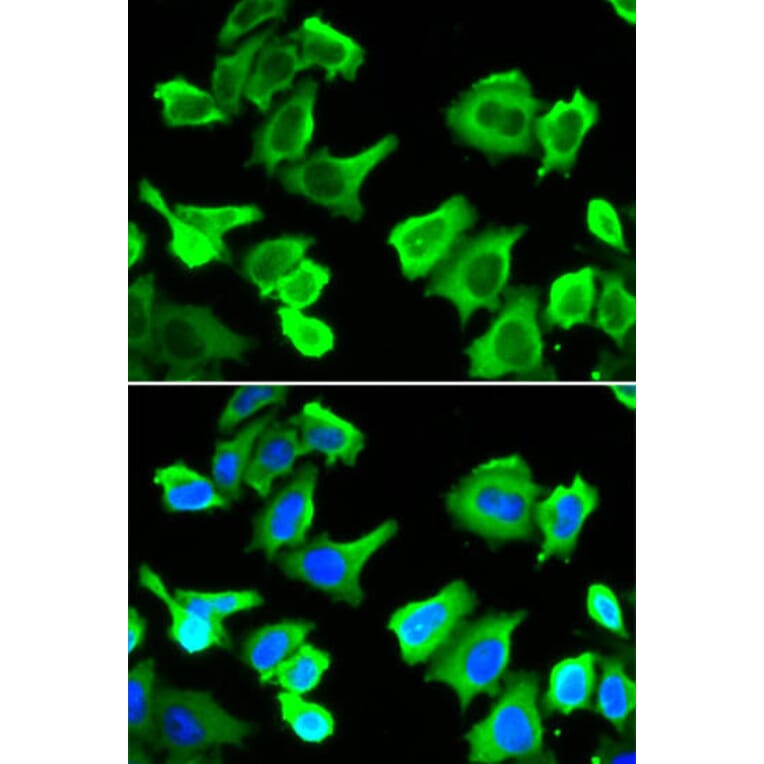Immunofluorescence - HSPB1 Antibody from Signalway Antibody (32036) - Antibodies.com