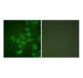 Immunofluorescence - TIMP2 Antibody from Signalway Antibody (33503) - Antibodies.com