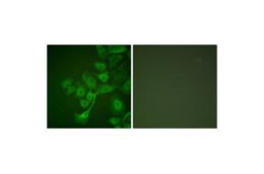 Immunofluorescence - TIMP2 Antibody from Signalway Antibody (33503) - Antibodies.com