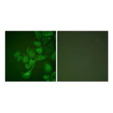 Immunofluorescence - TIMP2 Antibody from Signalway Antibody (33503) - Antibodies.com