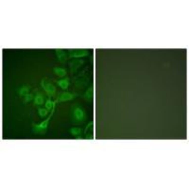 Immunofluorescence - TIMP2 Antibody from Signalway Antibody (33503) - Antibodies.com