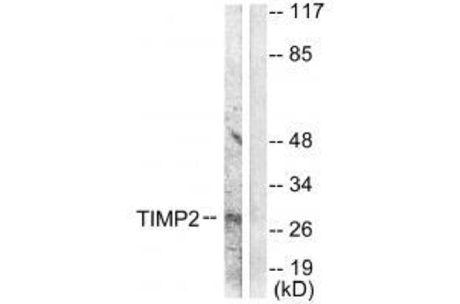 Western blot - TIMP2 Antibody from Signalway Antibody (33503) - Antibodies.com
