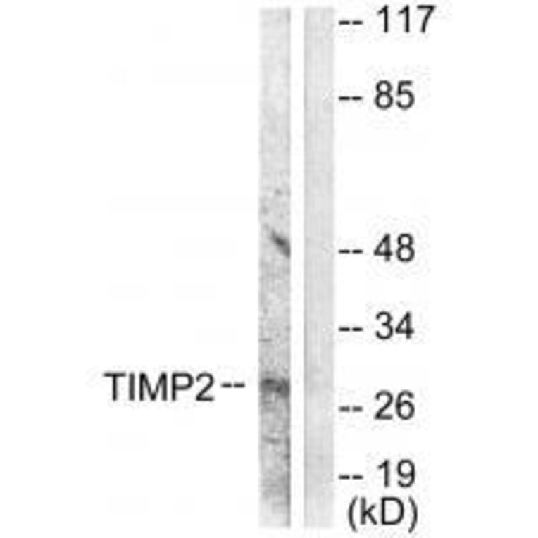 Western blot - TIMP2 Antibody from Signalway Antibody (33503) - Antibodies.com