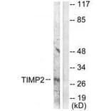 Western blot - TIMP2 Antibody from Signalway Antibody (33503) - Antibodies.com