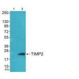 Western blot - TIMP2 Antibody from Signalway Antibody (33503) - Antibodies.com