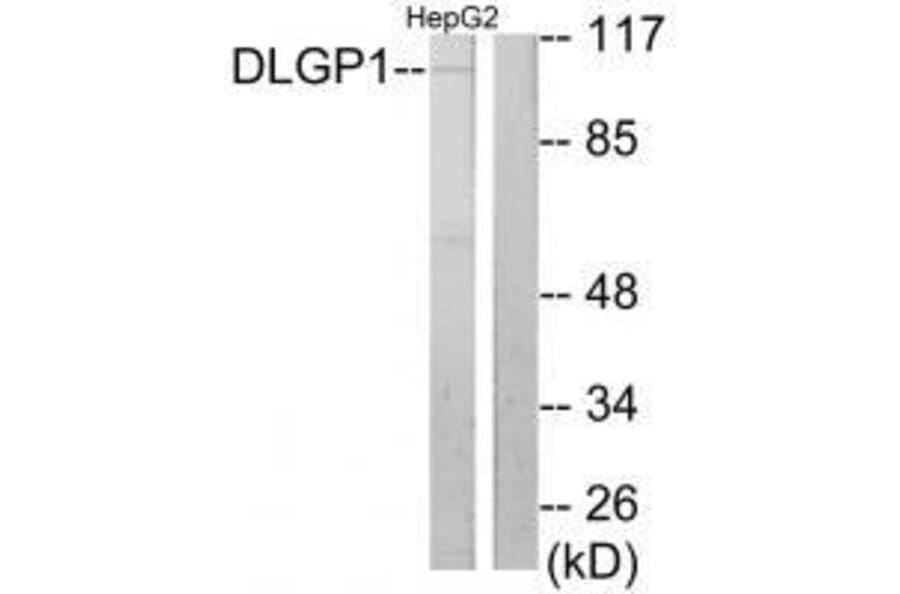 Western blot - DLGP1 Antibody from Signalway Antibody (33563) - Antibodies.com