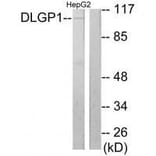 Western blot - DLGP1 Antibody from Signalway Antibody (33563) - Antibodies.com