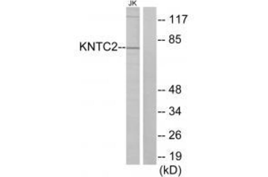 Western blot - KNTC2 Antibody from Signalway Antibody (33568) - Antibodies.com