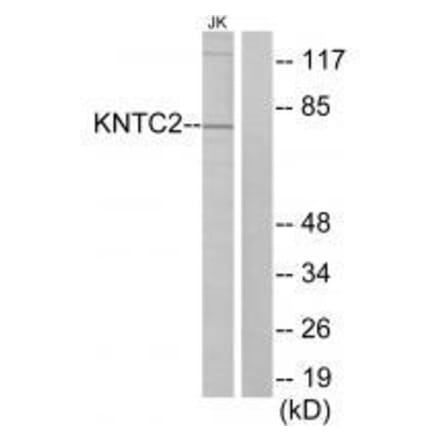 Western blot - KNTC2 Antibody from Signalway Antibody (33568) - Antibodies.com