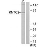 Western blot - KNTC2 Antibody from Signalway Antibody (33568) - Antibodies.com