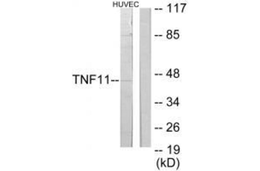 Western blot - TNF11 Antibody from Signalway Antibody (33569) - Antibodies.com