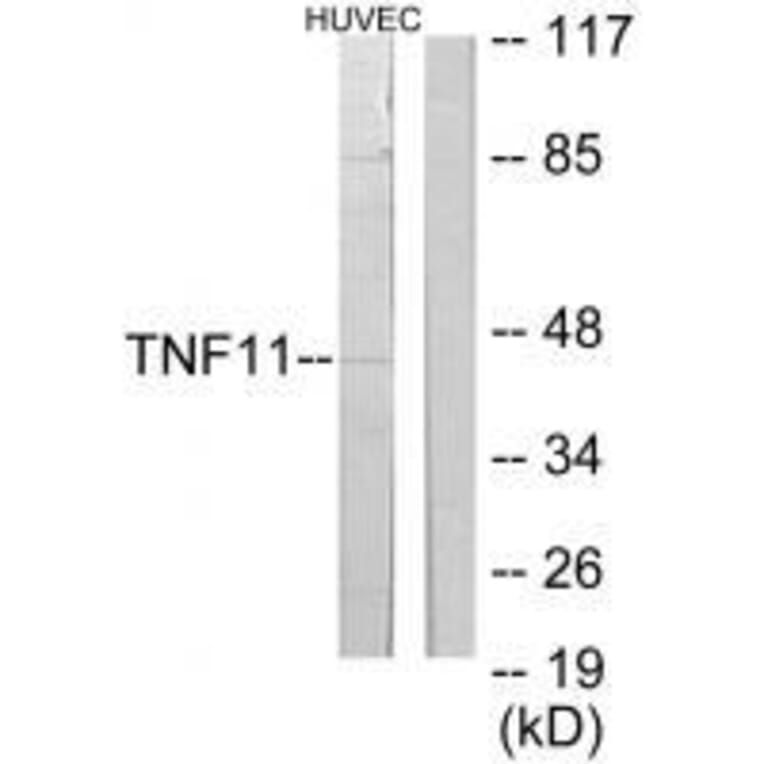 Western blot - TNF11 Antibody from Signalway Antibody (33569) - Antibodies.com