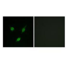 Western blot - TACC1 Antibody from Signalway Antibody (33610) - Antibodies.com
