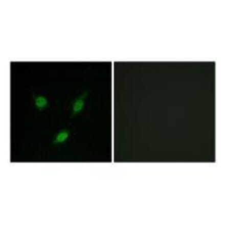 Western blot - TACC1 Antibody from Signalway Antibody (33610) - Antibodies.com