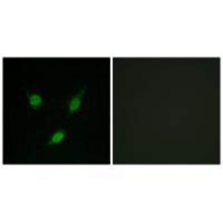 Western blot - TACC1 Antibody from Signalway Antibody (33610) - Antibodies.com