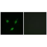 Western blot - TACC1 Antibody from Signalway Antibody (33610) - Antibodies.com