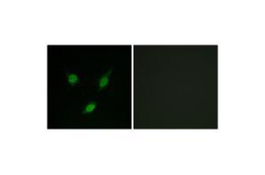 Immunofluorescence - TACC1 Antibody from Signalway Antibody (33610) - Antibodies.com