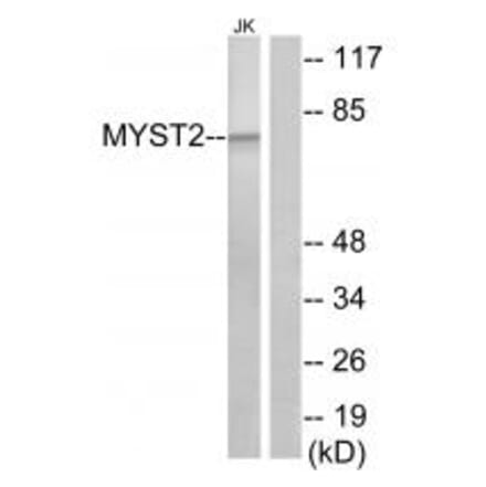Western blot - MYST2 Antibody from Signalway Antibody (33629) - Antibodies.com