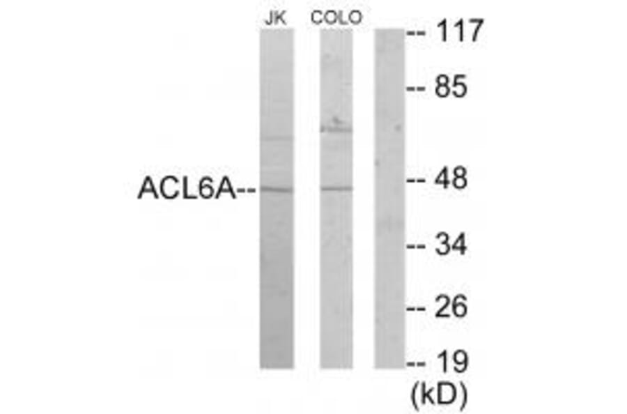 Western blot - ACL6A Antibody from Signalway Antibody (33644) - Antibodies.com