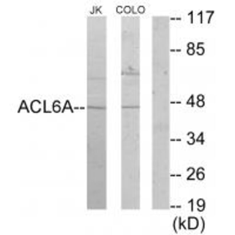 Western blot - ACL6A Antibody from Signalway Antibody (33644) - Antibodies.com