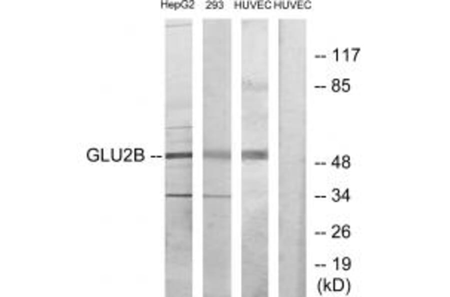 Western blot - GLU2B Antibody from Signalway Antibody (33679) - Antibodies.com