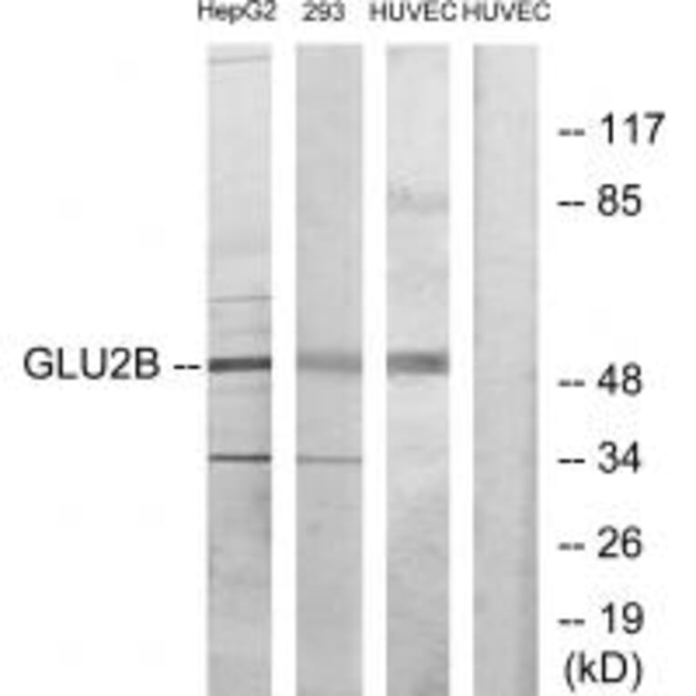 Western blot - GLU2B Antibody from Signalway Antibody (33679) - Antibodies.com