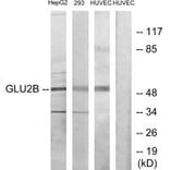 Western blot - GLU2B Antibody from Signalway Antibody (33679) - Antibodies.com