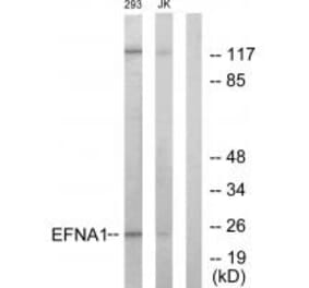 Western blot - EFNA1 Antibody from Signalway Antibody (33711) - Antibodies.com