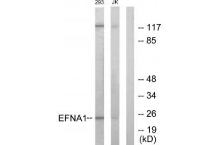 Western blot - EFNA1 Antibody from Signalway Antibody (33711) - Antibodies.com